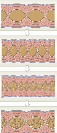 <p>Mainly circular muscle, contracting and relaxing repeatedly. Just churning/mixing the food in <strong>one spot</strong>, does not propel it anywhere. Mechanical digestion; increases absorption time. </p>