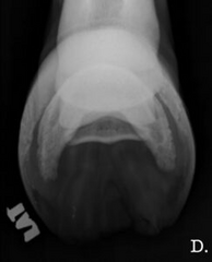<p>What radiographic projection is this?</p>