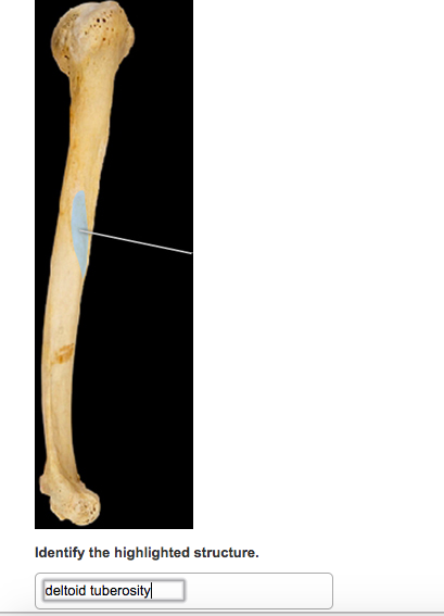 <p>tuberosity</p>