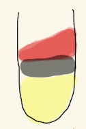 <p>TSI</p>