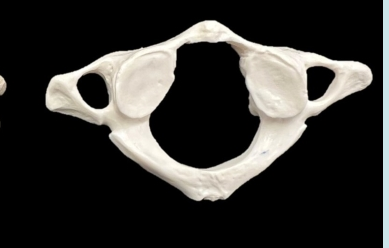 <p>C1</p>