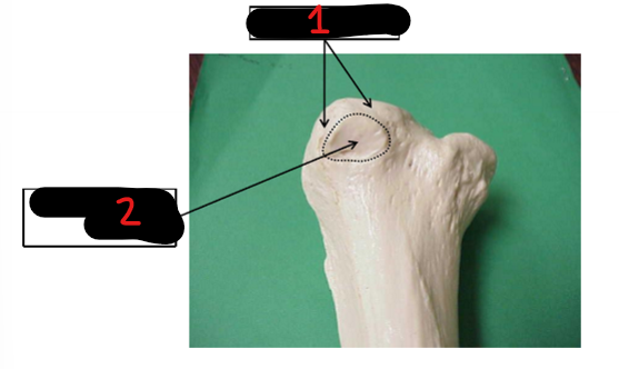 <p>both</p>