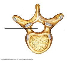 <p>Category: Typical Vertebra</p>