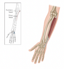 <p>What is the muscle highlighted?</p>