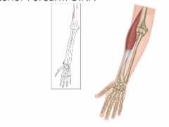 <p>What is the insertion of the brachioradialis?</p>