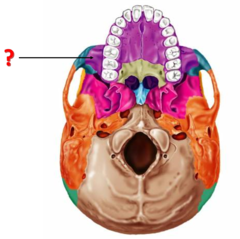 <p>Identify this bone.</p>
