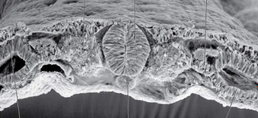 <p>Label the following:</p><ul><li><p>somite</p></li><li><p>neural tube</p></li><li><p>intermediate mesoderm</p></li><li><p>intraembryonic coelom</p></li><li><p>lateral plate mesoderm</p></li><li><p>notochord</p></li></ul><p></p>