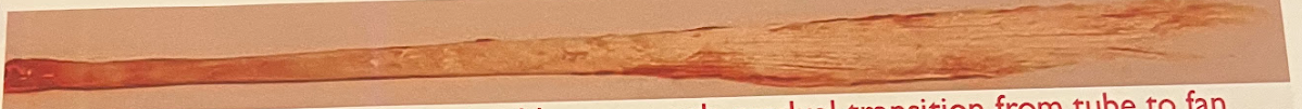 <p>-very flat, smooth and gradual transition from tube to fan</p><p>-most commonly confused with peroneus</p>
