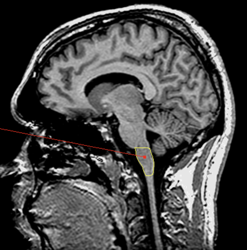 <p>What is the area highlighted called?</p>