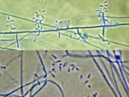 <p>Causes skin and nail infections (dermatophyte)</p><p>Beads on a wire morphology</p>