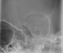 <p><span style="background-color: transparent;">&nbsp;Orbits - Rhese</span></p>