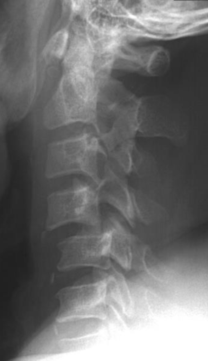 <p>What is the finding &amp; diagnosis</p>