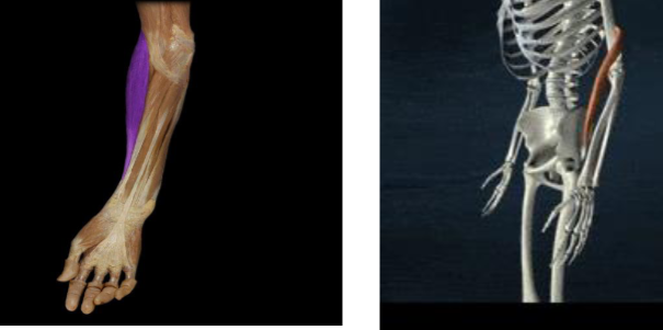 <p>elbow flexion, slight wrist radial deviation</p>