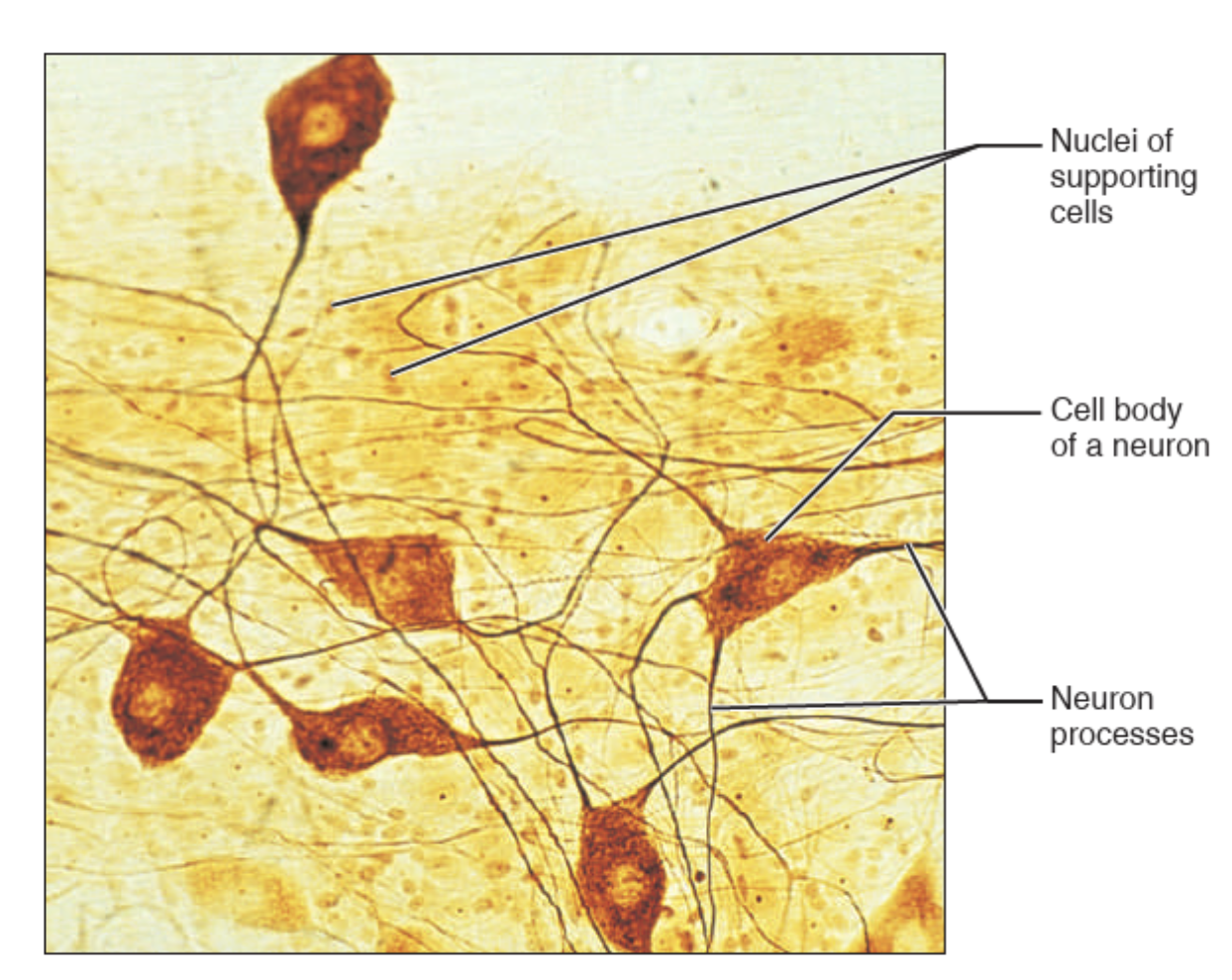 <p>What tissue is this? </p>