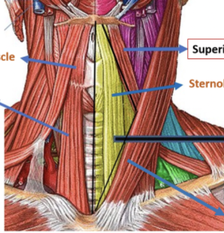 <p>boundaries</p><ul><li><p>anterior midline of the neck</p></li><li><p>superior belly of omohyoid muscle </p></li><li><p>sternocleidomastoid muscle </p></li></ul><p>- contains the trap mm. (infrahyoid mm.) - likes like straps on neck. They include sternohyoid, omohyoid, sternothyroid, and thyrohyoid muscles. They act to stabilize the hyoid bone and larynx in swallowing and speech.</p><p></p>