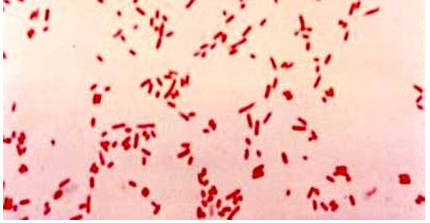 <p>What do these Gram-stained bacteria look like? </p>