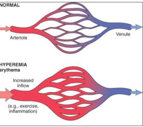 <p>It is an adaptive local increase in blood volume in tissues due to a change in environment</p>