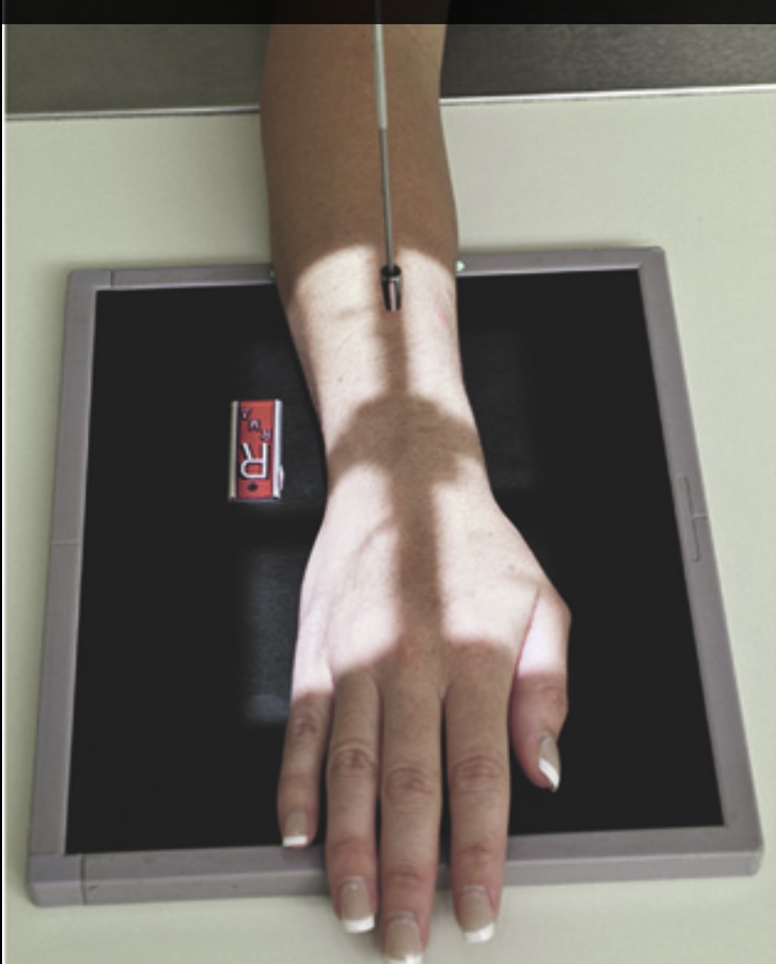 <p>How many carpal bones should be included in this image?</p>