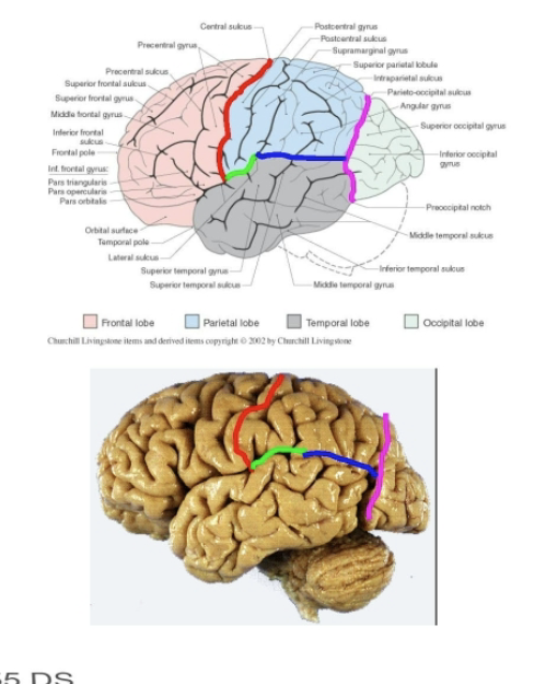 <p>Sensory and multimodal associative function</p><ul><li><p>Contents</p><ul><li><p>Primary somatosensory cortex (postcentral gyrus)</p></li><li><p>Sensory association areas w/ functions including understanding written language (usually left hemisphere)</p></li></ul></li></ul><p>Boundaries</p><ul><li><p>Laterally, parietal lobes lie posterior to the <mark data-color="red" style="background-color: red; color: inherit;">central sulcus</mark> and anterior to the extension of the pariteo-occiptal sulcus to the pre-occipital notch. </p></li><li><p>Above the lateral fissure and a <mark data-color="blue" style="background-color: blue; color: inherit;">line</mark> between approx. the middle of the lateral fissure and the extension of the parieto-occipital sulcus. </p></li></ul><p></p>