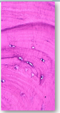 <p>Where are the osteocytes?</p>