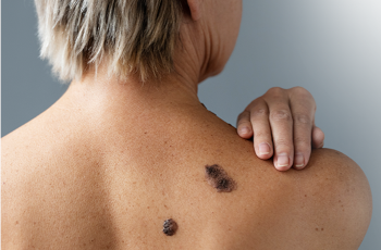 <p>(<em>adjective</em>) happening often to many people in many places</p><p>“Skin cancer is the most _______ type of cancer.”</p>