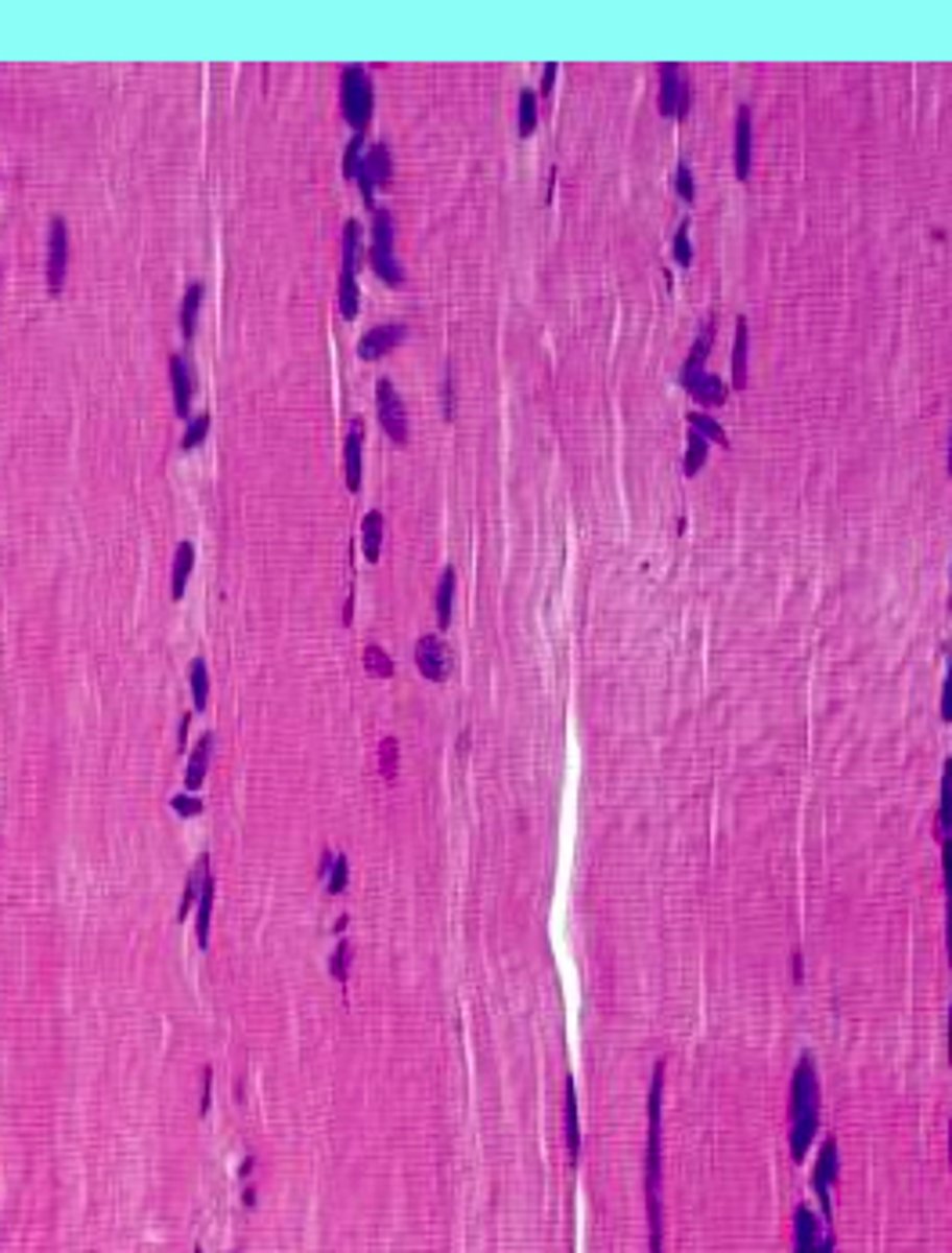 <p>voluntary somatic muscle that makes up the gross skeletal muscles, moves or stabilizes bones and other structures</p>