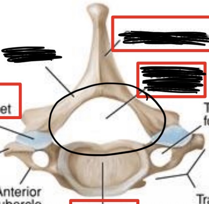 <p>What is this part of the vertebrae?</p>