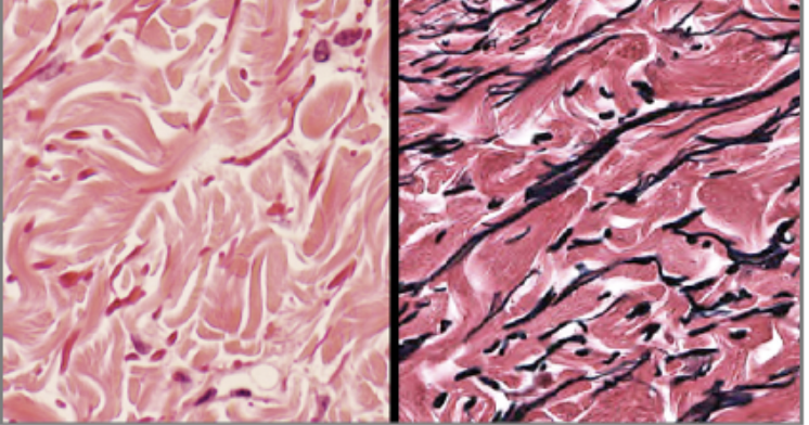 <p>What kind of fibers are shown?</p>