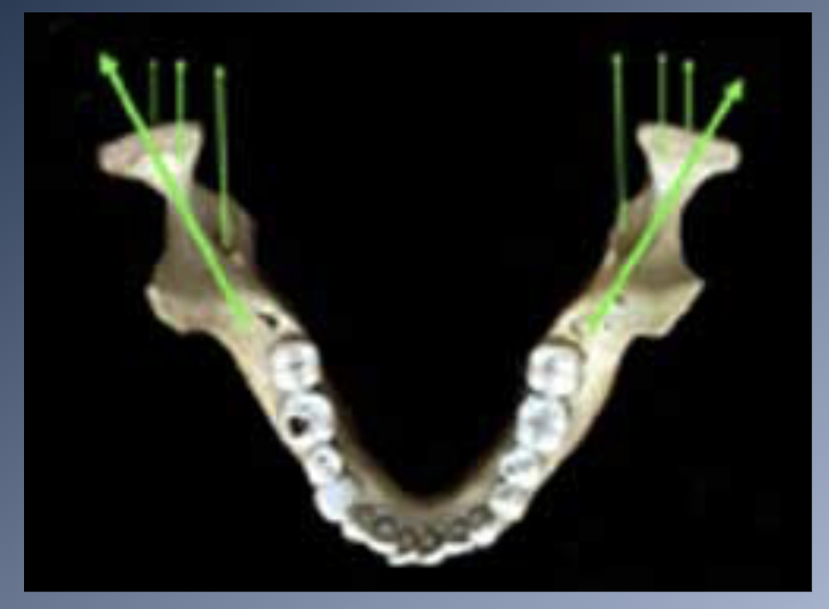 <p><span>1. Definite sequence in which growth is completed in the different planes of space: width → length → height.</span><br><span>2. Growth in WIDTH</span><br><span>1. Includes dental arches.</span><br><span>2. Completed before the adolescent growth spurt.</span><br><span>3. Affected minimally by adolescent growth changes.</span><br><span>4. Intercanine width is more likely to DECREASE after age 12</span><br><span>5. As the jaws grow in length posteriorly, they also grow wider</span></p>