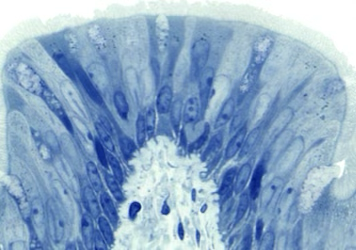 <p>Pseudostratified Columnar Epithelium</p>