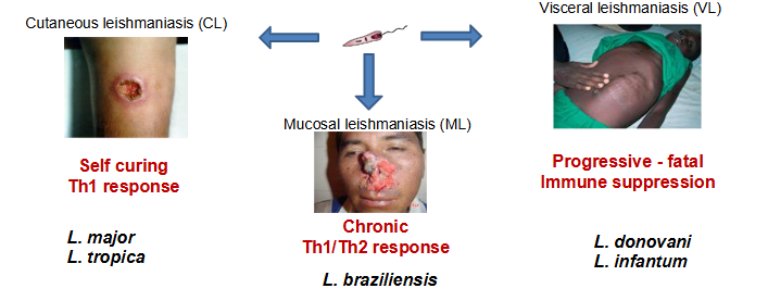 <p>What is leishmaniasis?</p>