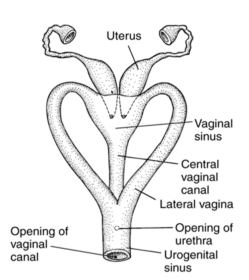 <p>Median birth canals</p>