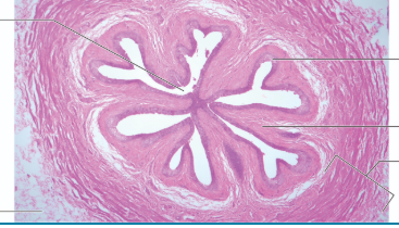 <p>word bank</p><p>what is this???</p><p>lumen </p><p>urothelium</p><p>lamina propria</p><p>smooth muscle</p><p>adventitia</p>