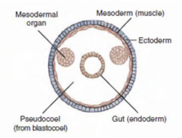 <p>What type of body cavity is this?</p>