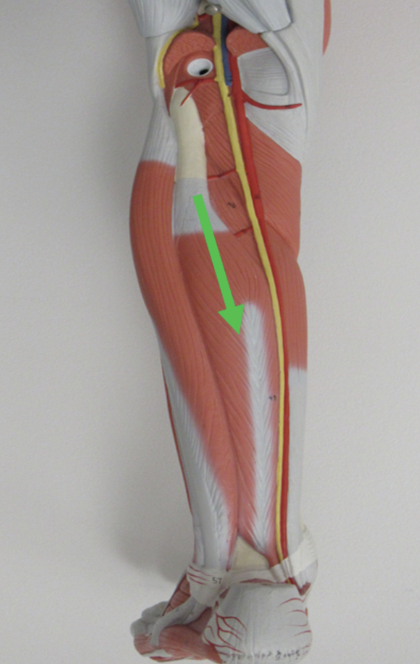 <p>Identify the muscle indicated by the pointer.</p>