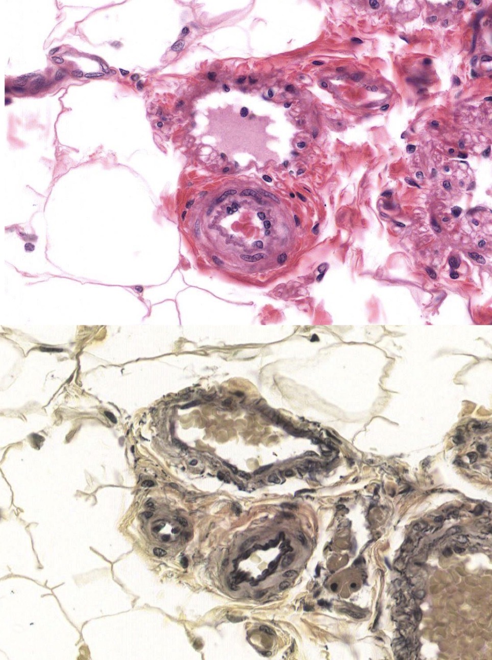 <p>Identify the Vessel and the Layer pictured (Top and Bottom in both)</p>