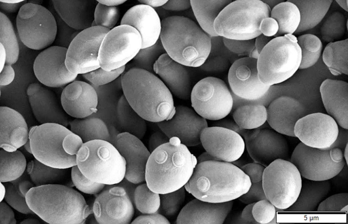 <p>yeast</p>