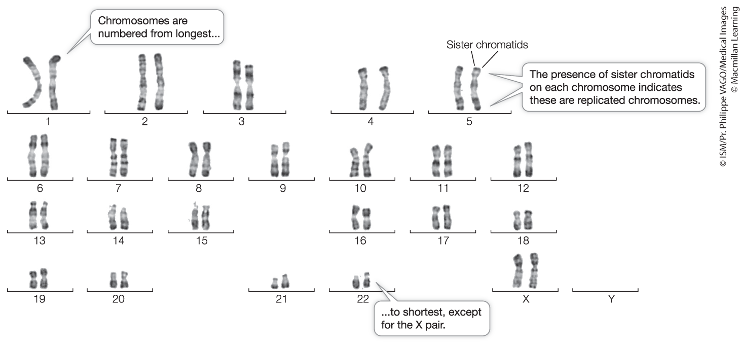 <p>Karyotype</p>