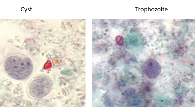 <p>Cyst: 4 nuclei; lacks peripheral chromatin</p><p>Trophozoite: Irregular blot-like karyosome</p>