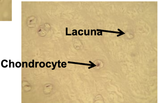 <p>What cartilage is this?</p>