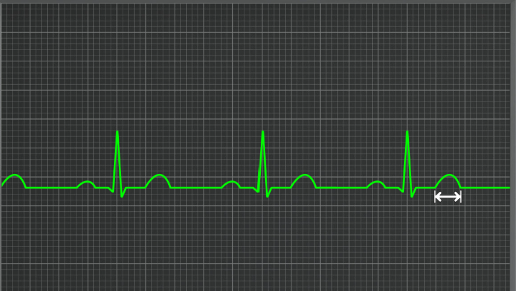 <p>what wave is this</p>
