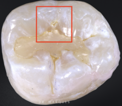 <p>What is the classification?</p>