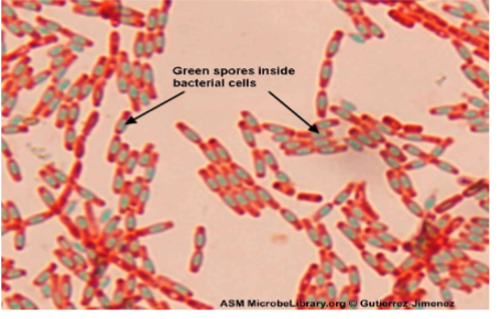 <p>What kind of Stain?</p>