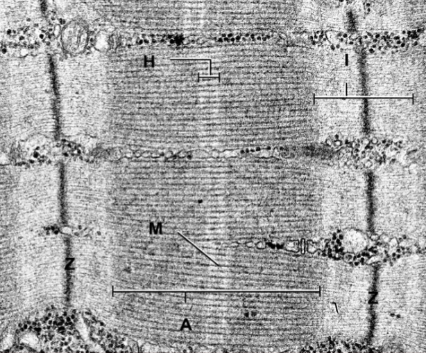 <p>What band is thick and on either side of the z bands?</p>