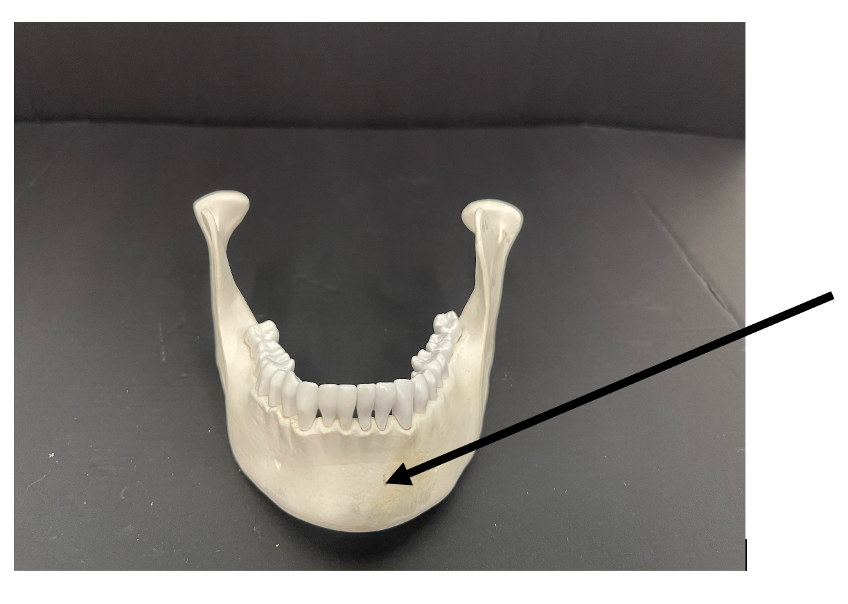 <p>The horizontal portion of the mandible is called the _____.</p>
