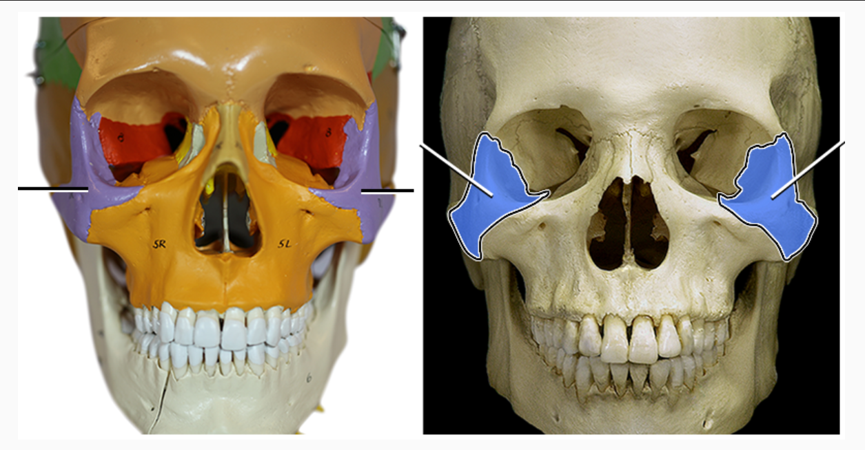 <p>What structure is indicated</p>