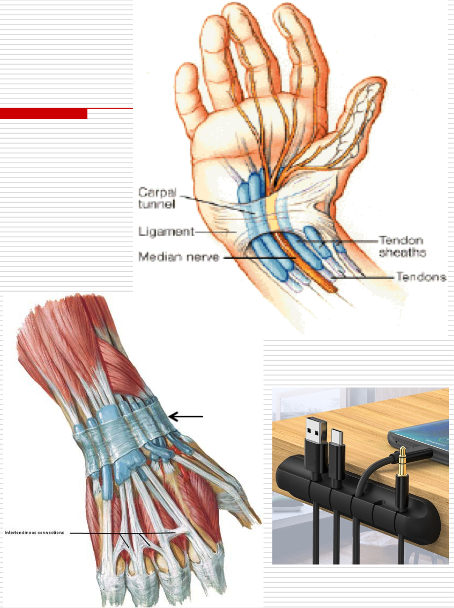 <p>Holds tendons of the wrist and hand musculature held in place </p><ul><li><p>Transverse bands of fibrous tissue on the palmar and dorsal aspects of the proximal hand </p></li><li><p>Carpal tunnel </p></li></ul><p></p>