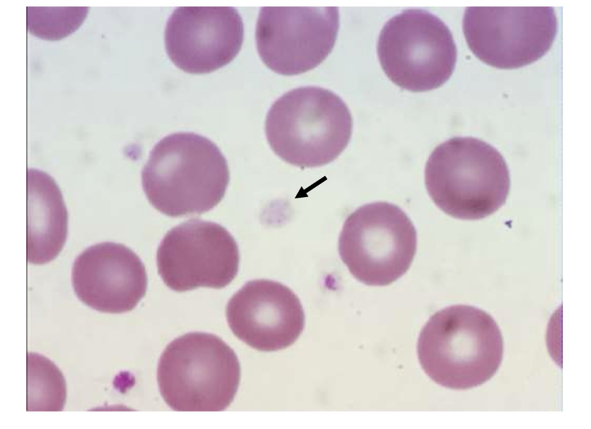 <p>Name this abnormality, and how can we tell?</p>
