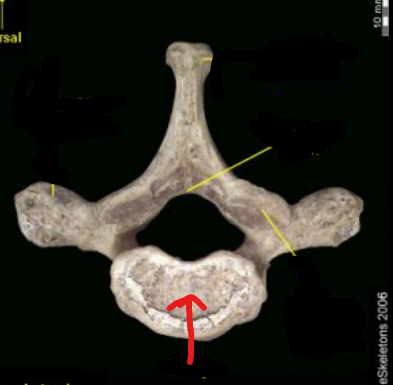 <p>What part of the vertebrae is this?</p>