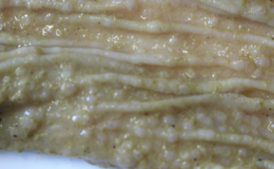 <p><u>Localisation:</u> Abomasum of sheep</p><p><u>Pathology:</u> Also <em>Ostertagia</em> in cattle</p><ol><li><p>Larvae enter gastric glands and surrounding mucosa responds with nodular hyperplasia</p></li><li><p>Parietal/chief cells replaced by goblet cells → Neutral pH and more mucus</p></li><li><p>Inflammation and oedema</p></li><li><p>Morocco leather appearance of mucosa</p></li><li><p>Villous atrophy of small intestine</p></li><li><p>PLE</p></li></ol><p></p>